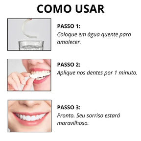 Faceta Dentária - WhitePremium® + BRINDE