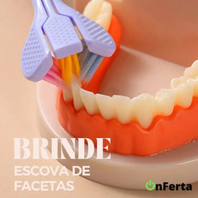 Faceta Dentária - WhitePremium® + BRINDE